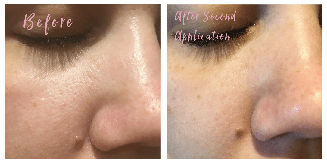 Sand&amp;SkyReview_Comparison2